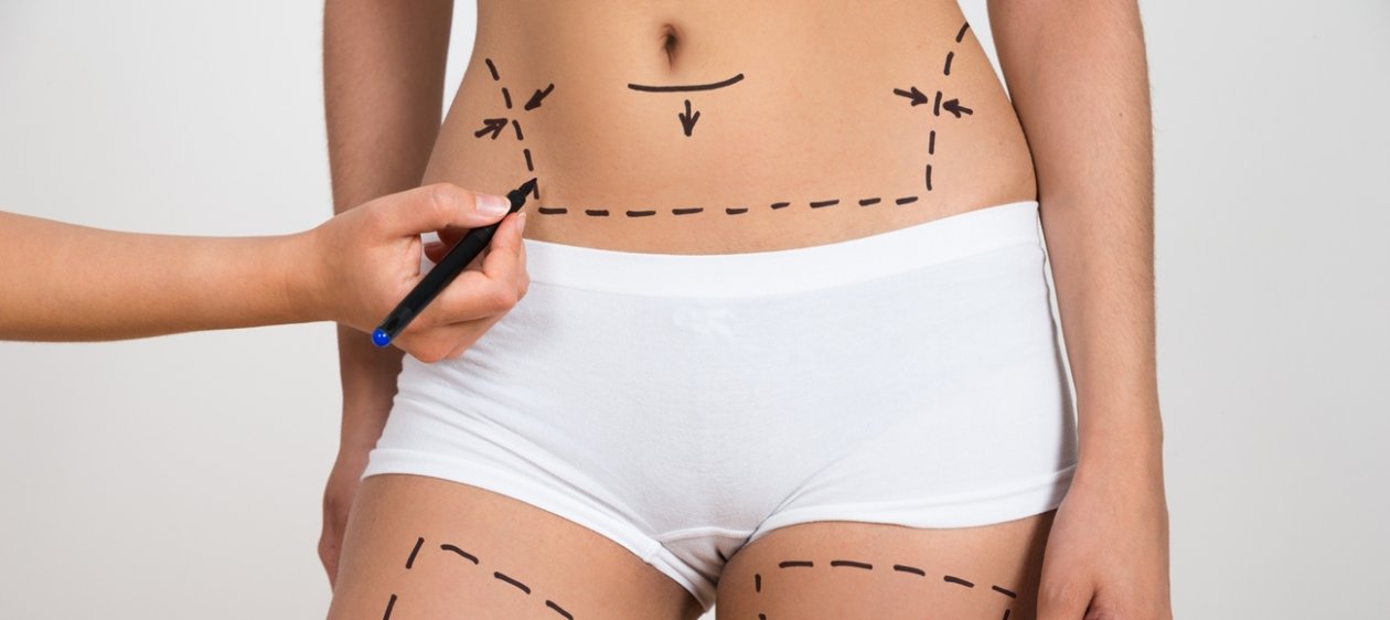¿Pensando en una cirugía plástica? Qué considerar antes del