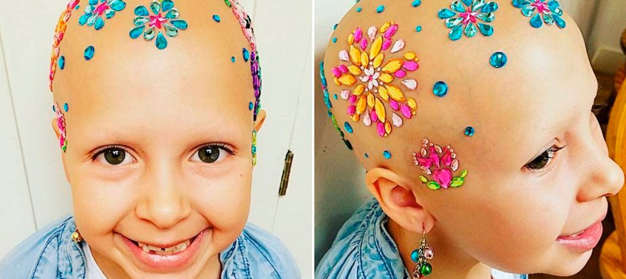 Esta pequeña niña vive su alopecia día a día con looks únicos