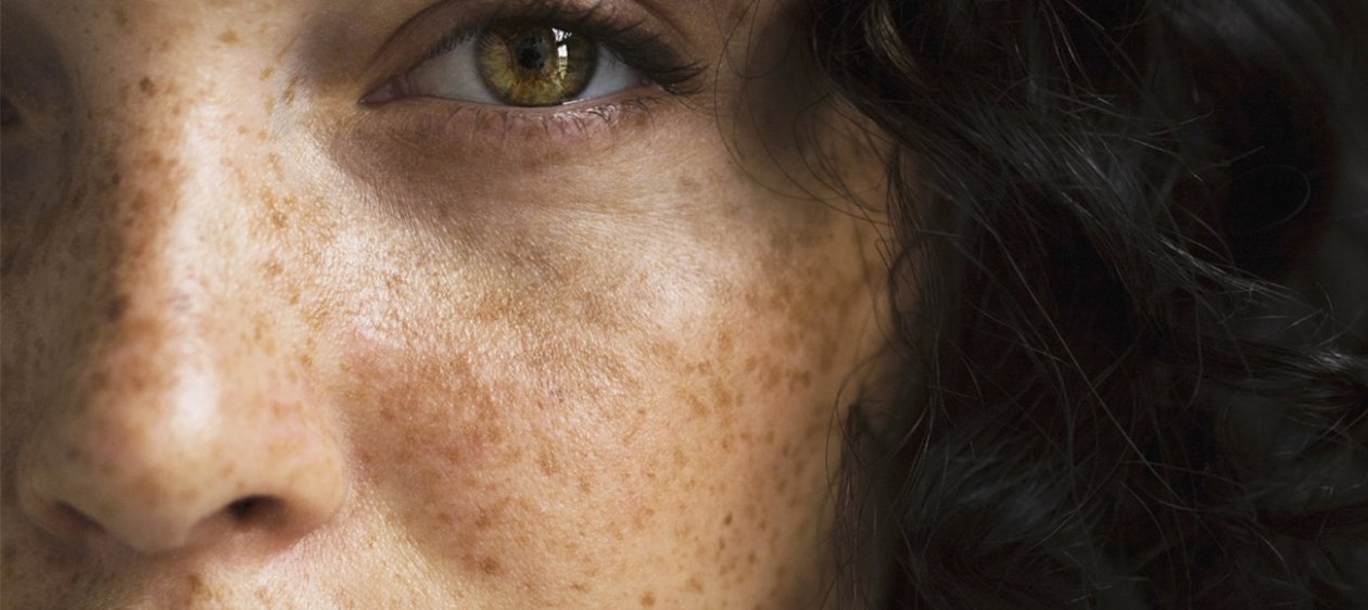 #TipDeBelleza: Innovador tratamiento para las manchas en la cara