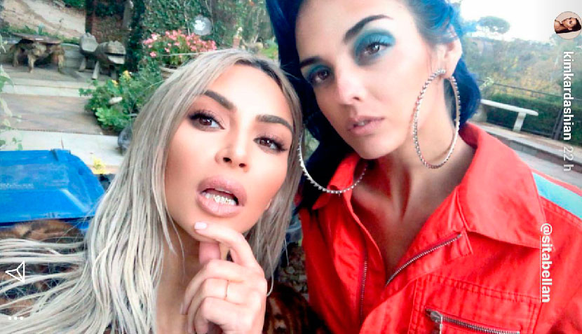 Kim Kardashian dentadura de oro 