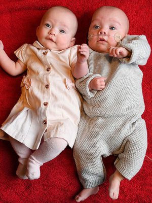 Mujer dio a luz a gemelos con 12 días de diferencia