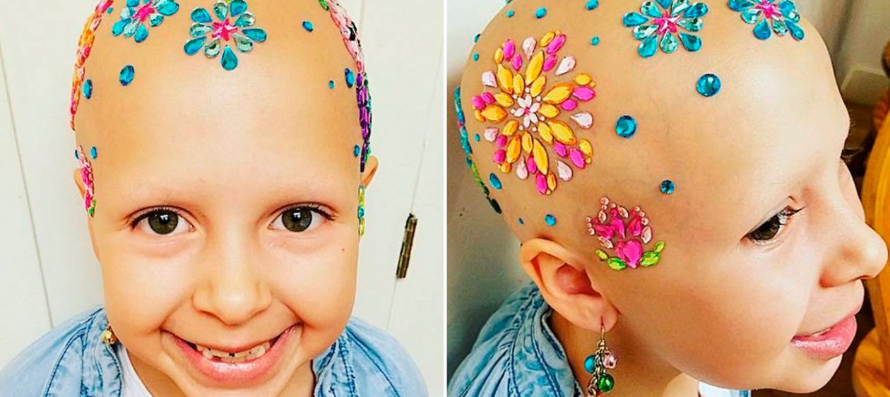 Esta pequeña niña vive su alopecia día a día con looks únicos