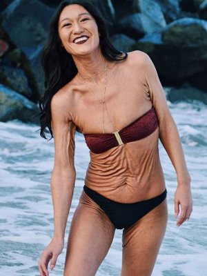 La modelo que destaca por la curiosa afección a su piel