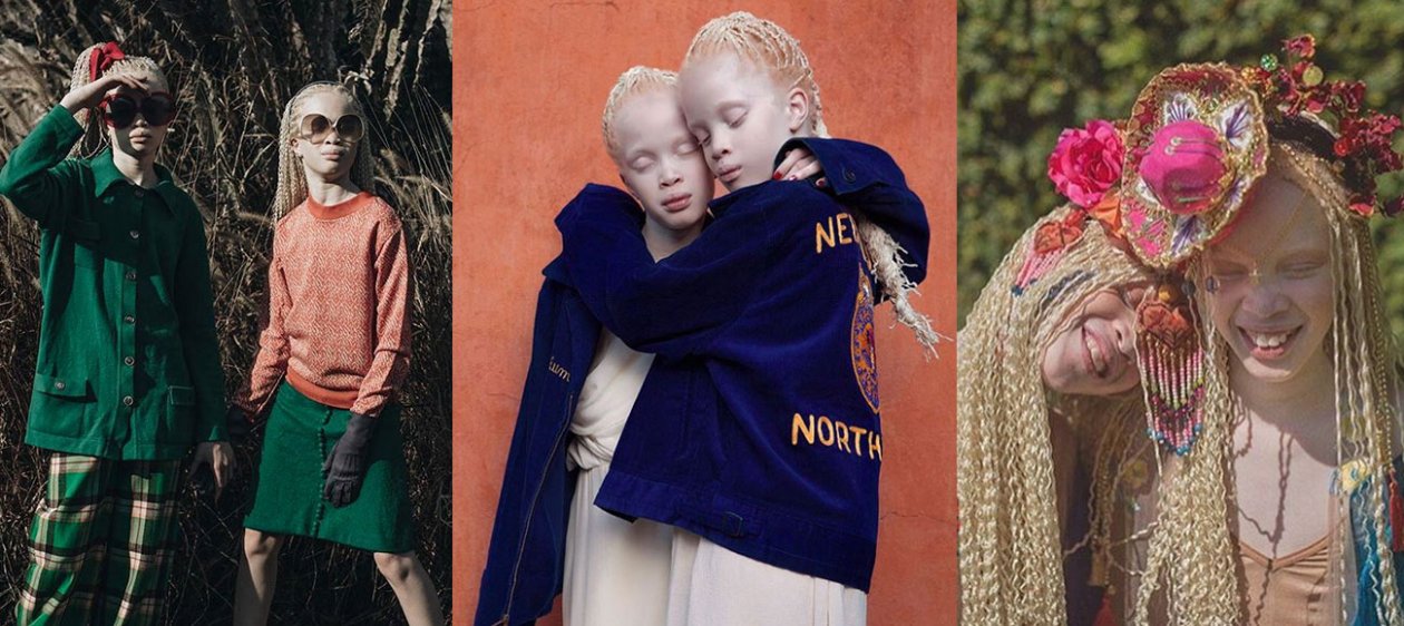 Las hermanas albinas que revolucionan la escena de la moda