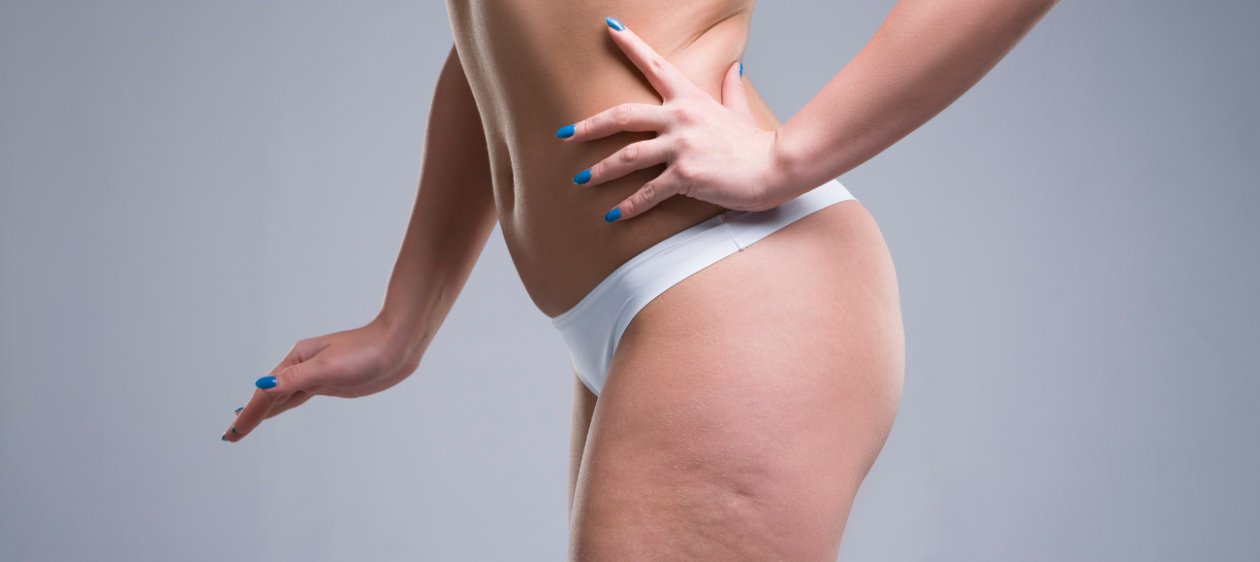 7 Mitos sobre la celulitis que debes dejar de creer