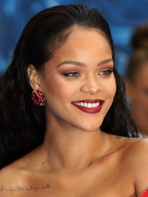 Rihanna mostró sus piernas sin depilar y sus estrías en Instagram