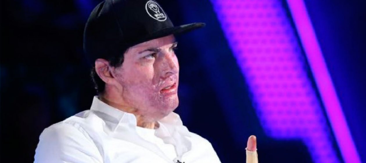 La foto que evidencia la rápida recuperación de Ignacio Lastra