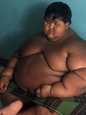 Bajó 100 kilos: El radical cambio del 'niño más gordo del mundo'