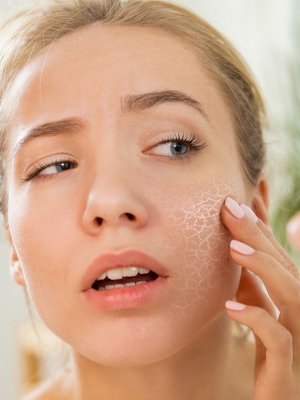 ¿Cómo saber si tu piel está estresada?
