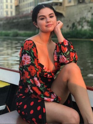 El efecto que tiene en Selena Gómez el tratamiento del Lupus El efecto que tiene en Selena Gómez el tratamiento del Lupus