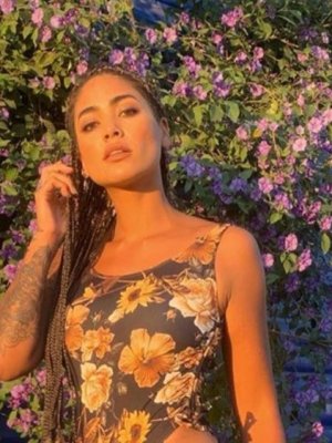 Camila Recabarren contó que sufre de particular enfermedad en sus manos