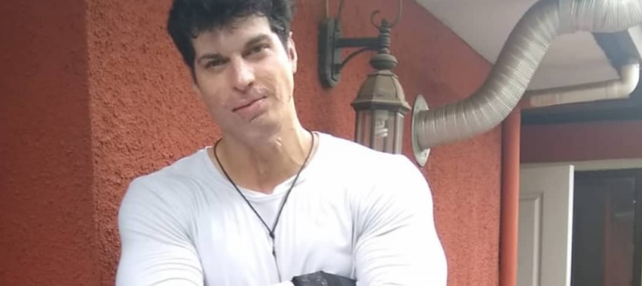 Ignacio Lastra impacta al mostrar su tonificado abdomen a tres años de su accidente