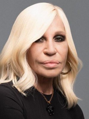 Desde Donatella Versace a Camilo Sesto: Los desastres estéticos de los famosos