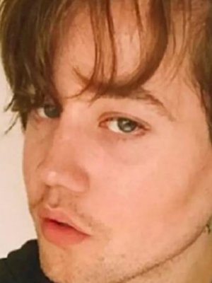 Nicolás Yunge entrega detalles de su delicado estado de salud: 