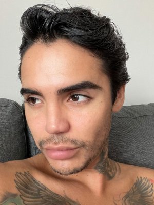 Leo Méndez Jr. preocupó con fotos de su cara tras realizarse una bichectomía