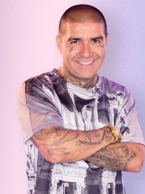 DJ Méndez se somete a popular procedimiento estético: mostró antes y después