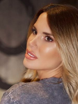 ¡Recibió los resultados! Gala Caldirola comparte la verdad detrás de su mamografía