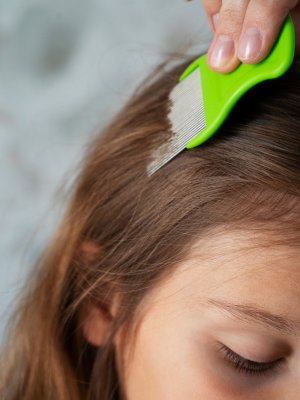 El secreto para evitar la pediculosis estaría en el pH de la piel
