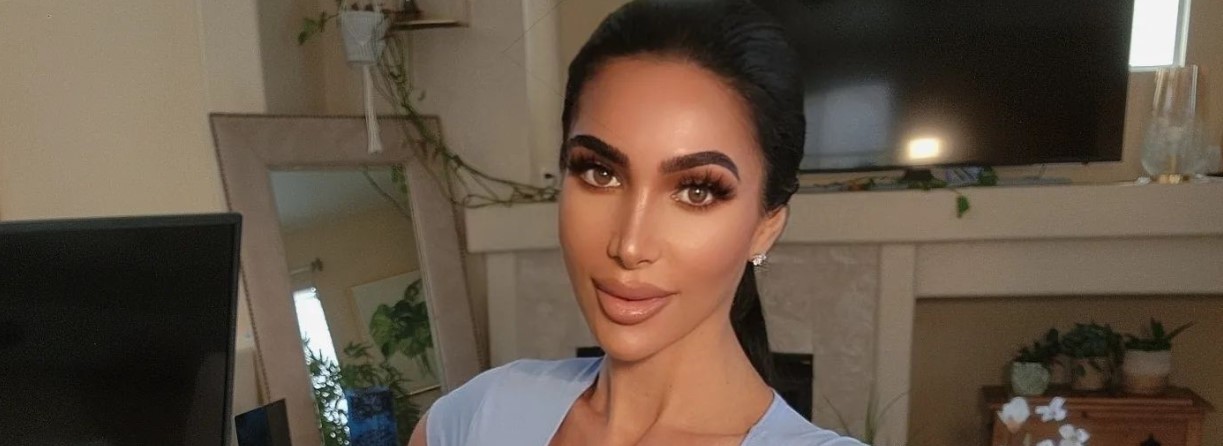 Doble de Kim Kardashian muere tras someterse a cirugía plástica