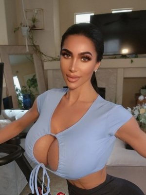 Doble de Kim Kardashian muere tras someterse a cirugía plástica