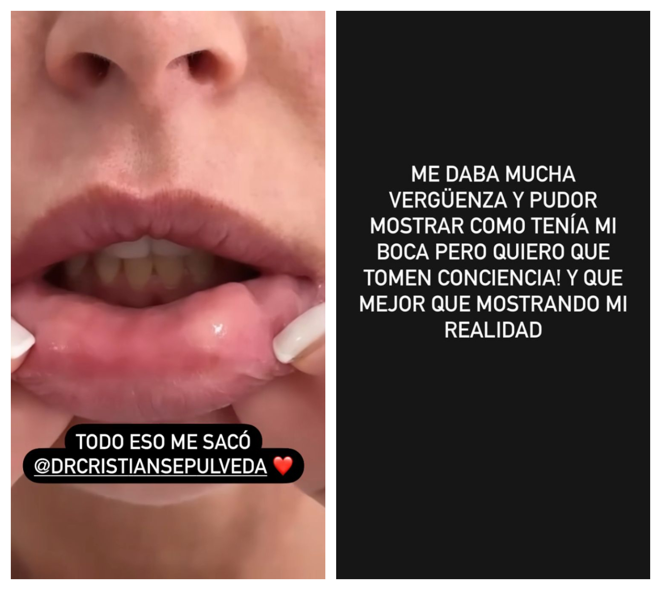 Imagen foto_00000002