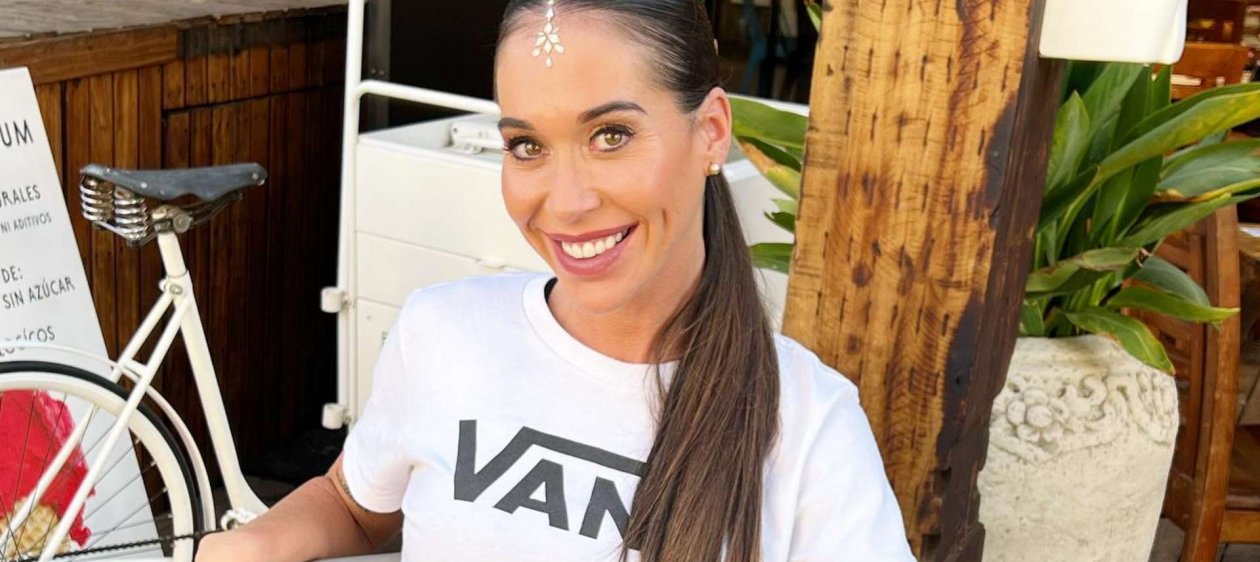 Vale Roth se sometió a nueva cirugía estética por importante motivo: