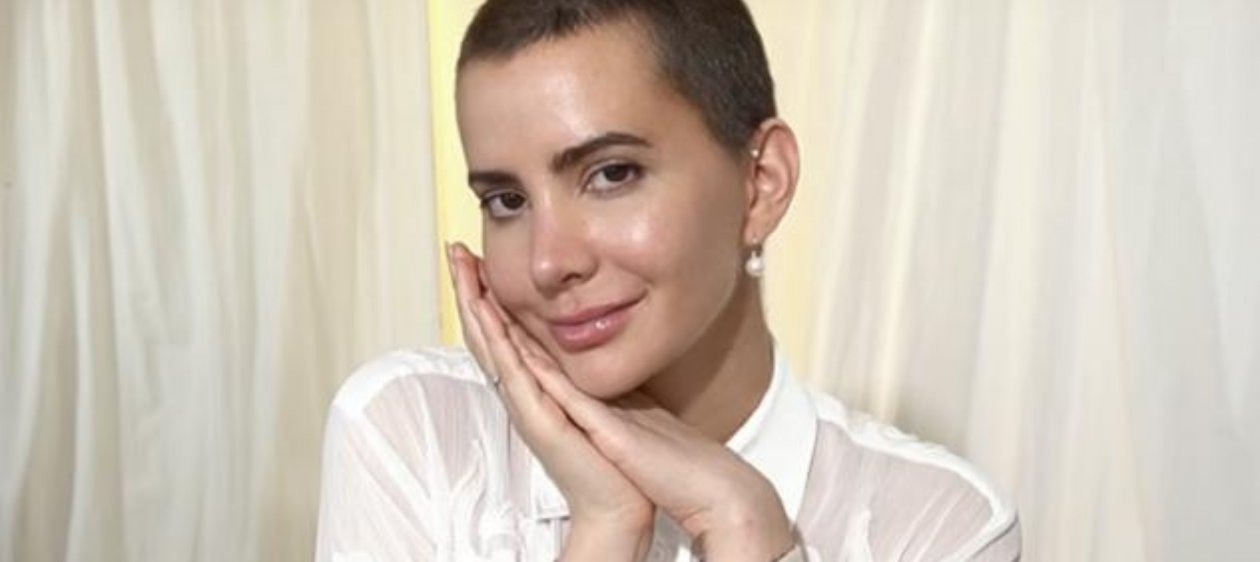 Aylén Milla da cuenta de su menopausia temprana: