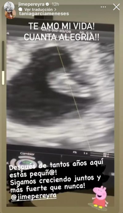 Ecografía del bebé de María Jimena Pereyra y Tania García