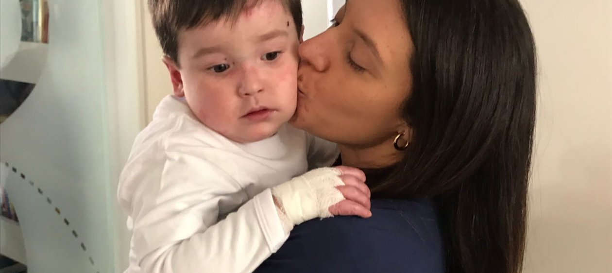 Debra Chile realiza campaña para construir el Primer Centro Médico para Niños con Piel de Cristal