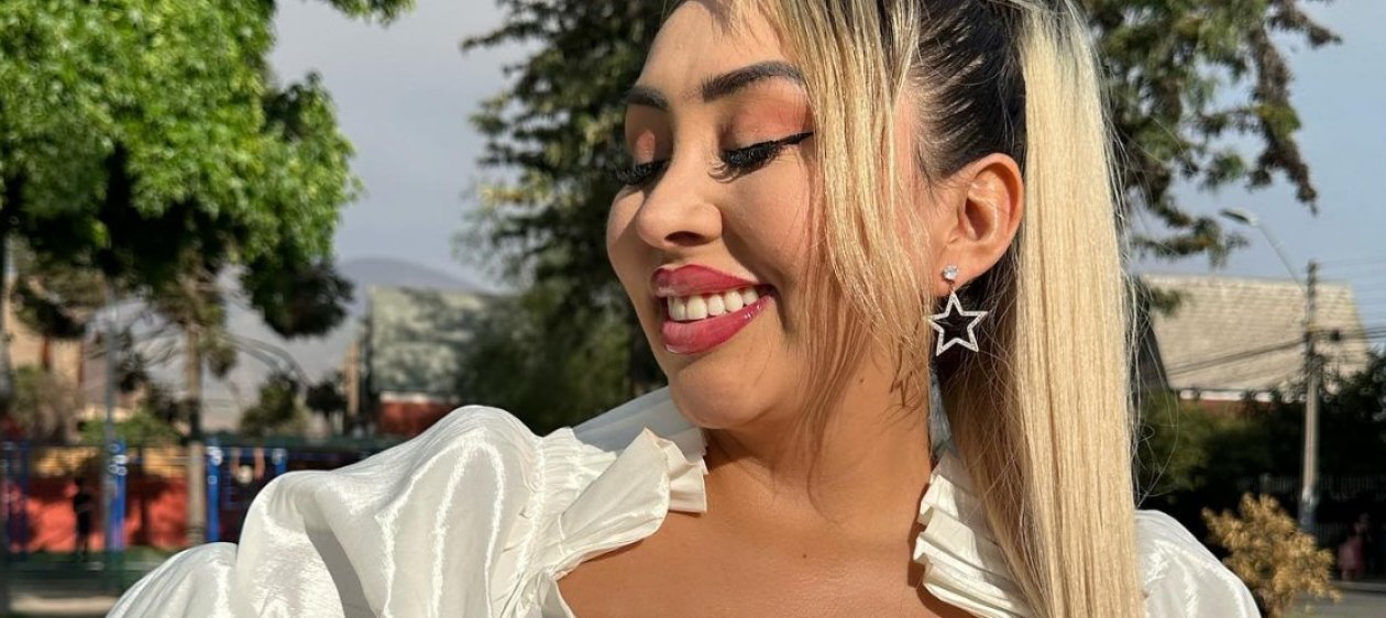 Naya Fácil mostró las primeras imágenes tras someterse a lipotransferencia en Colombia