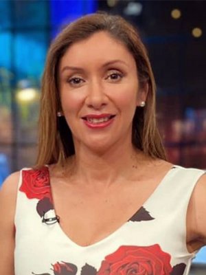 Angélica Sepúlveda reflexiona sobre la alopecia con fotografías de su cabello
