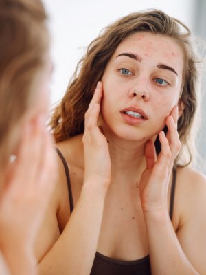 Dermorexia: la obsesión con el skincare ya tiene nombre