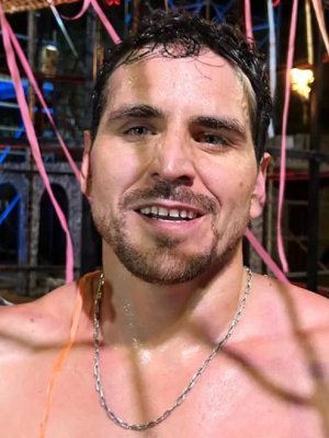 ¡Cambio total! Pangal Andrade mostró su nueva dentadura