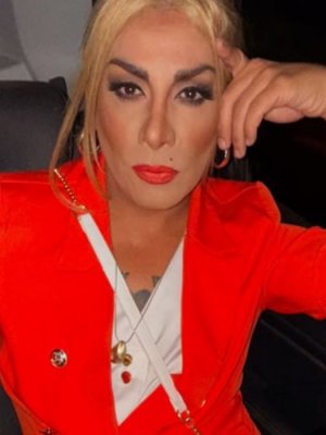 Botota Fox actualizó su estado tras cirugía estética: 