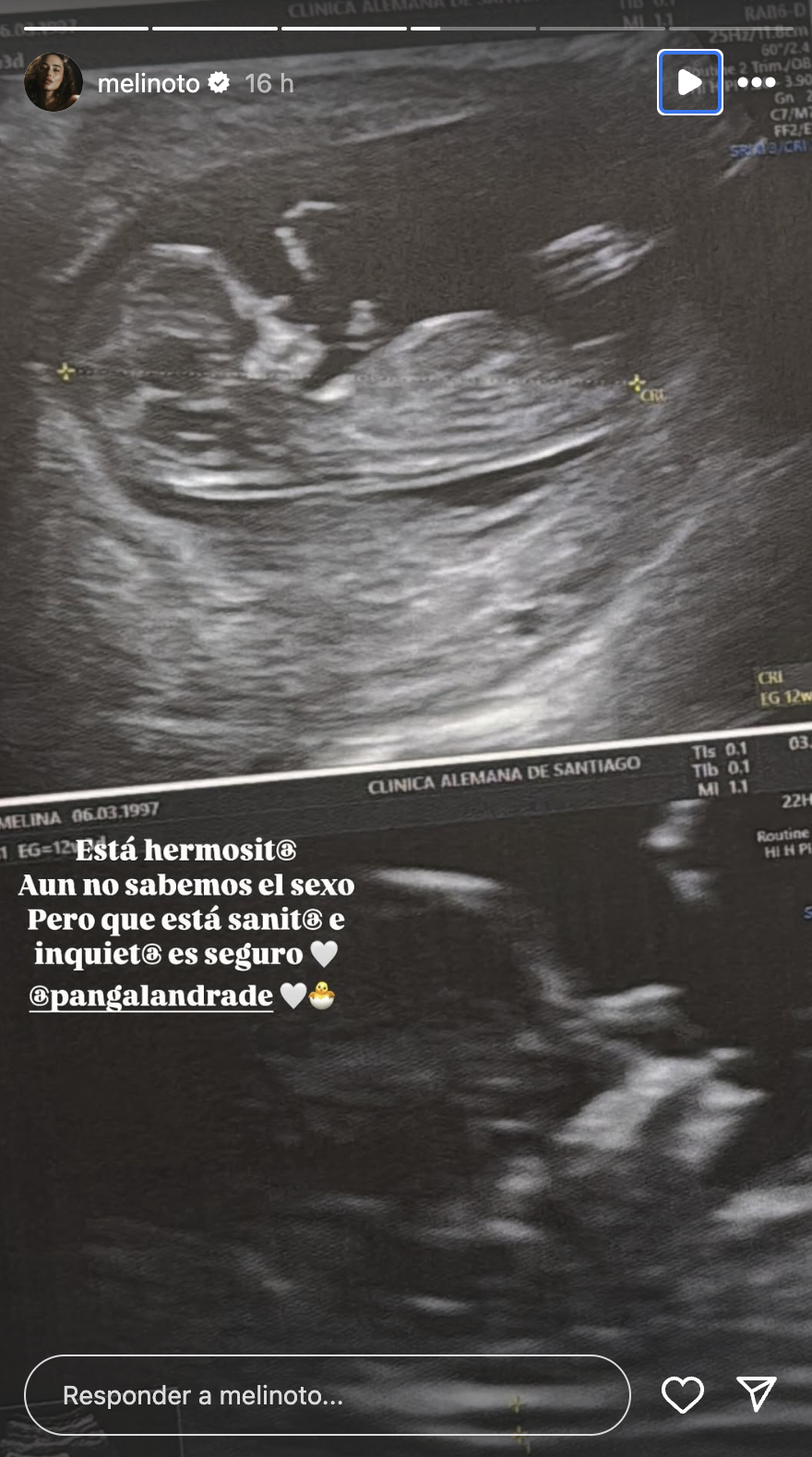Imagen foto_00000001