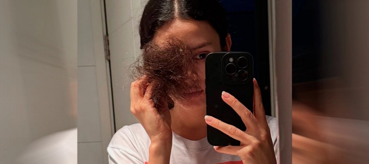 Karla Melo compartió la transformación que ha tenido tras enfrentar el cáncer