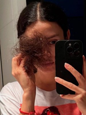 Karla Melo compartió la transformación que ha tenido tras enfrentar el cáncer Karla Melo compartió la transformación que ha tenido tras enfrentar el cáncer