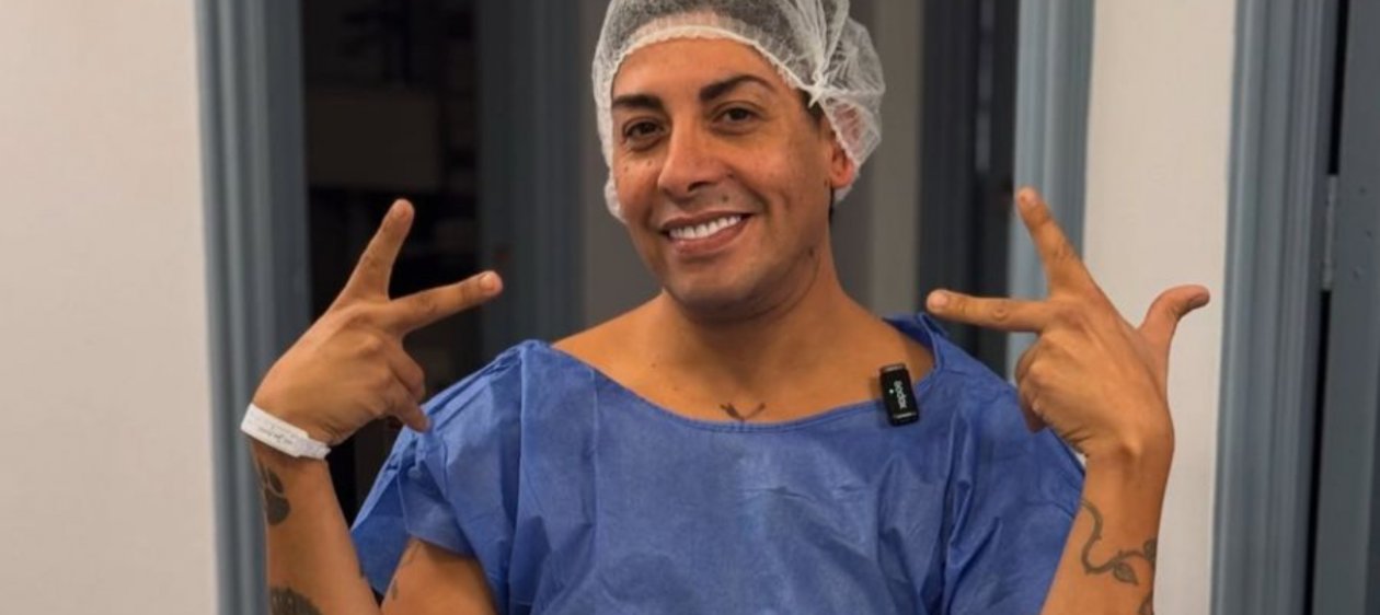 Botota Fox compartió el antes y después de su operación estética