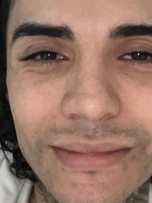Leo Méndez Jr. hospitalizado luego de presentar complicación tras operación: 