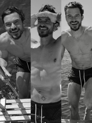 Orlando Bloom se realizó costoso procedimiento para 