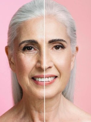 Volumisse: la tecnología que revoluciona la belleza regenerativa sin bisturí ya está en Chile