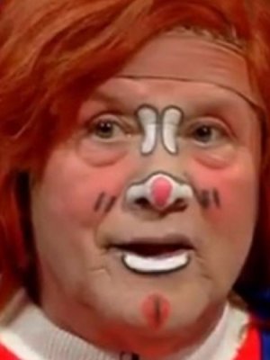 Actualizan estado de salud de Tachuela Chico tras delicada operación: 