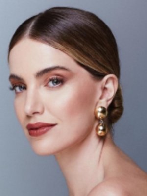 Millaray Viera y su dura lucha contra enfermedad autoinmune: 