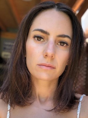 ¡Chao arrugas! Rosario Bravo se sometió a tratamiento estético