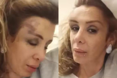 Imagen foto_00000021