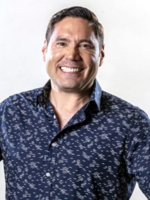 Pancho Saavedra reveló el procedimiento estético al que se sometió