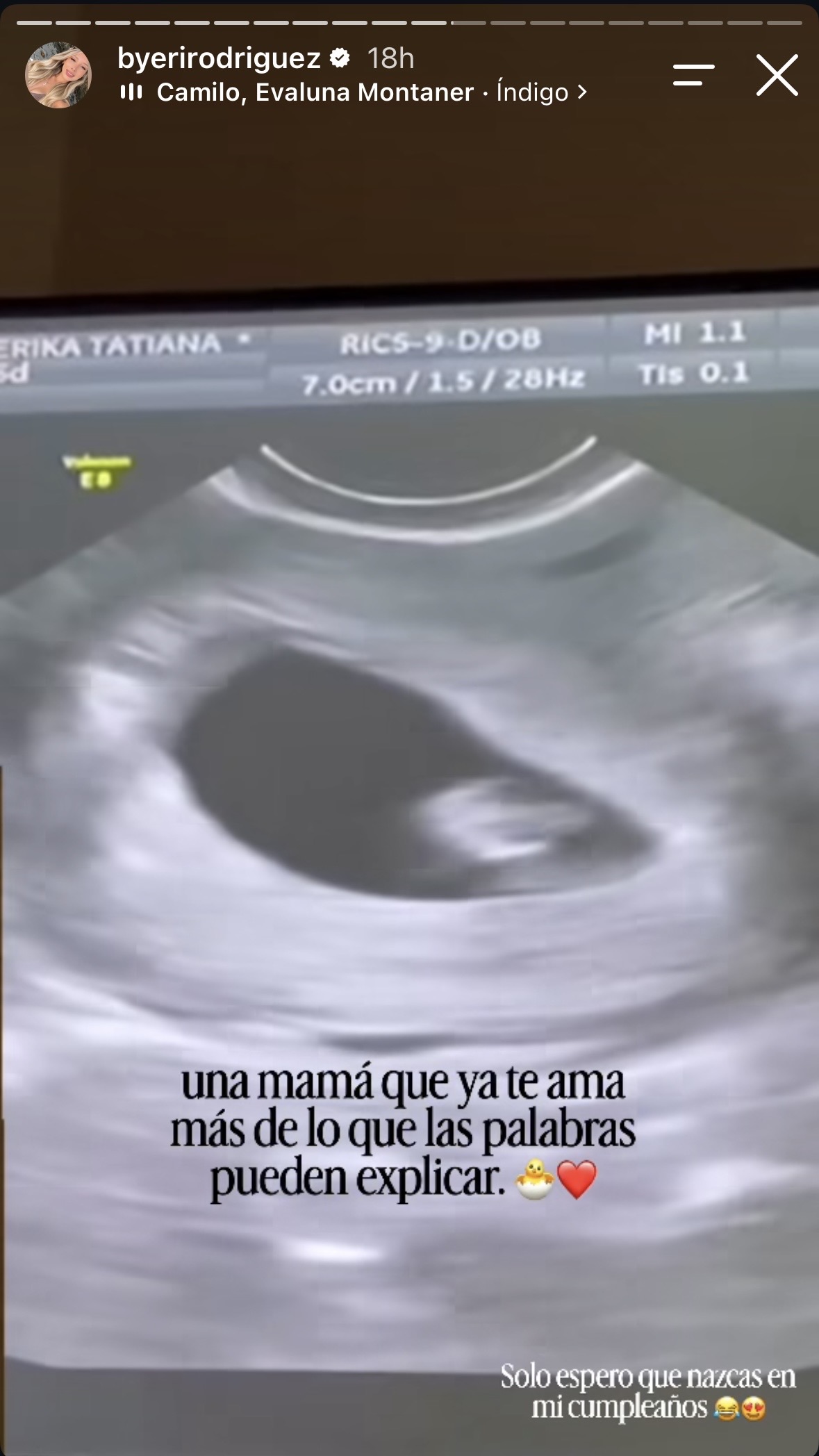 Imagen foto_00000021